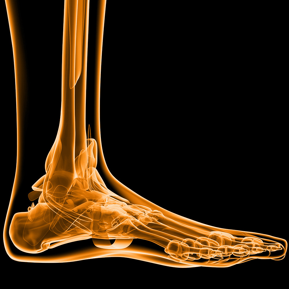 X-ray Foot